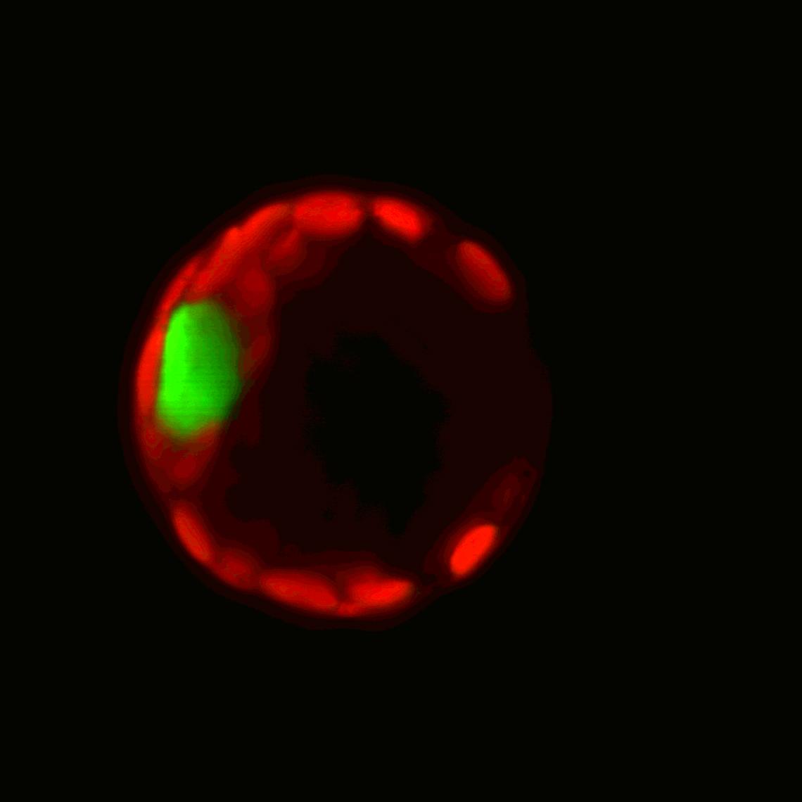 Thanks to a special imaging technique, the nucleus is visible here in green inside a plant cell. 